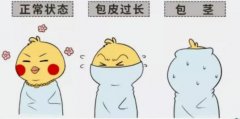 包皮过长会引起包皮炎吗？”